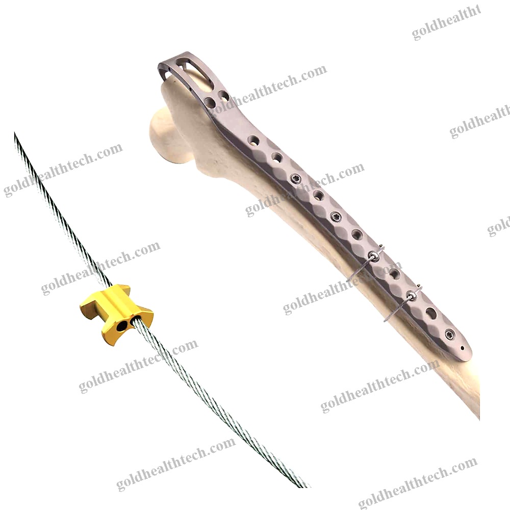 Metallic Multifilament Bone Cerclage Wiring