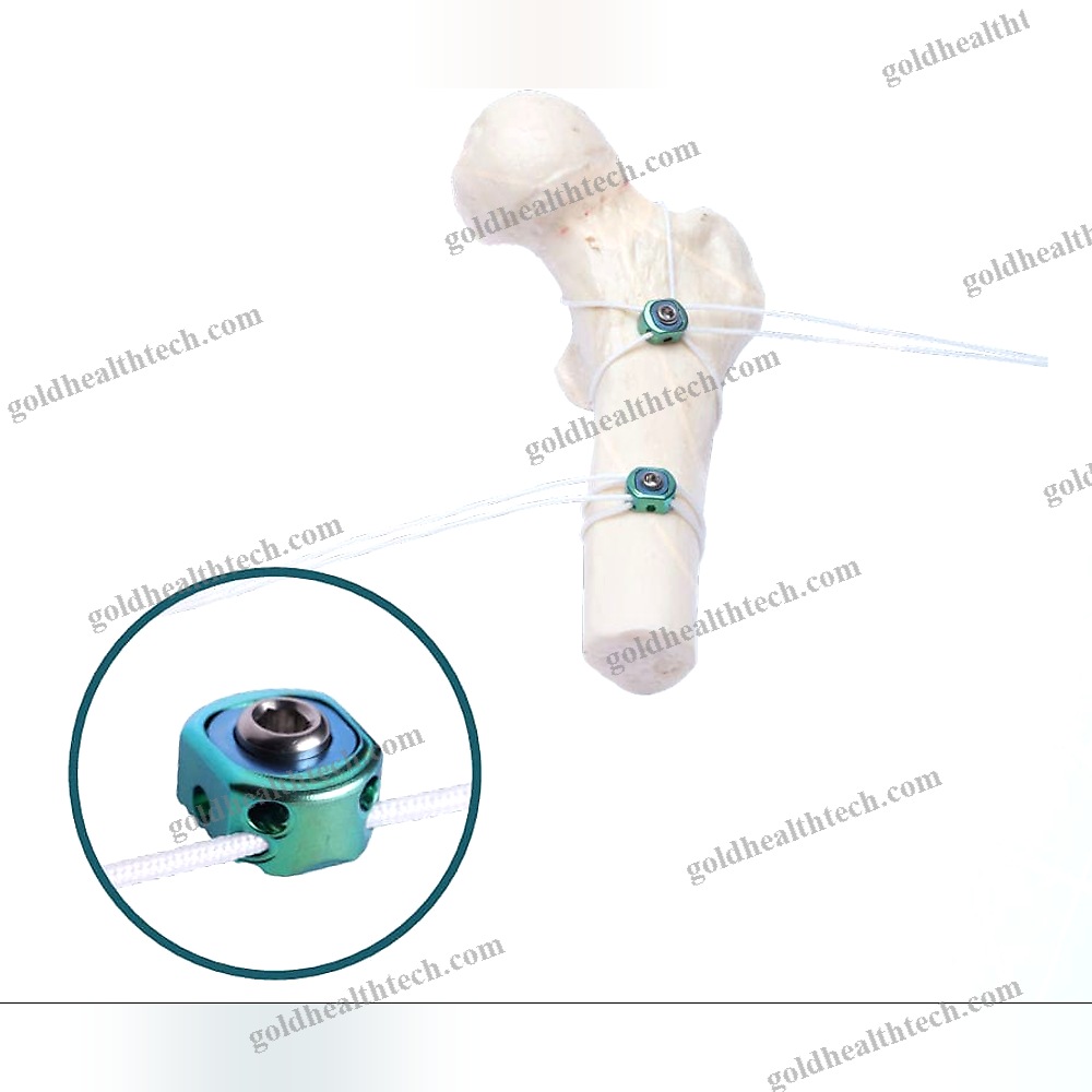 Metallic Multifilament Bone Cerclage Wiring