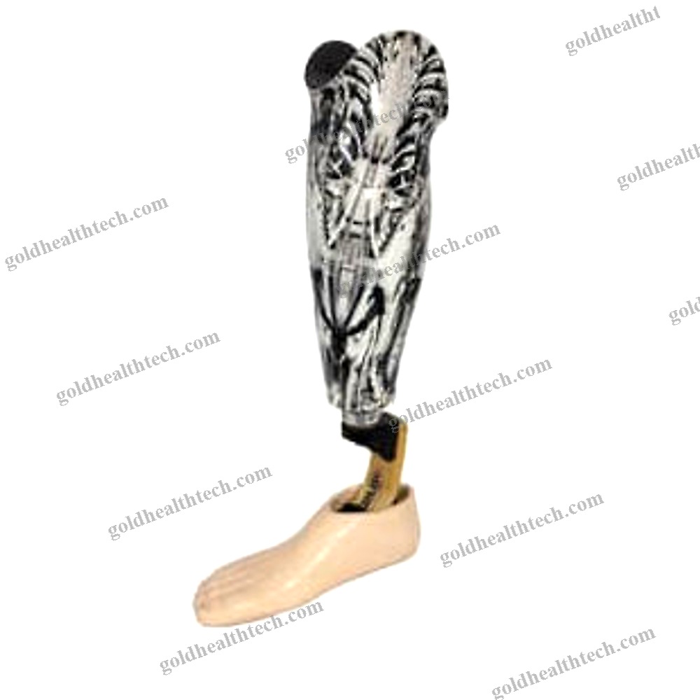 Microprocessor-Controlled Prosthetic Knee Joint