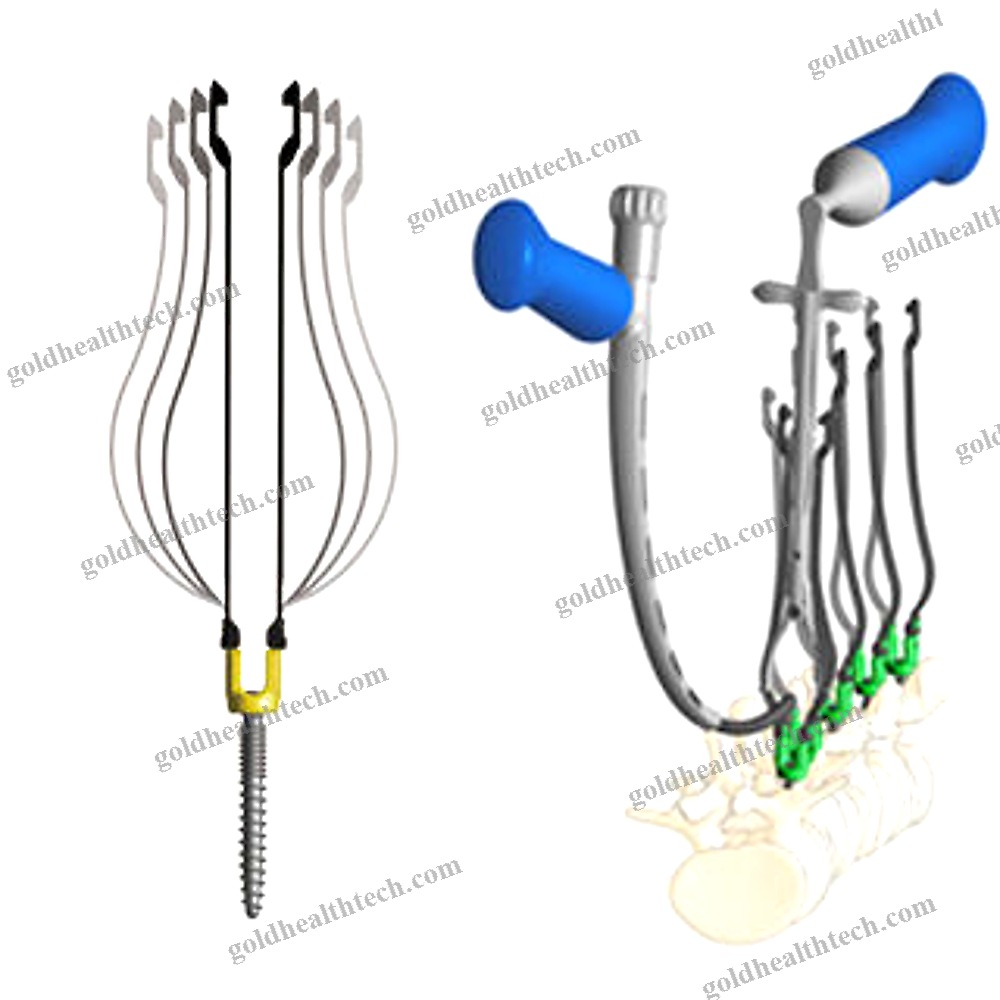 Minimally Invasive Pedicle Screw Positioning System