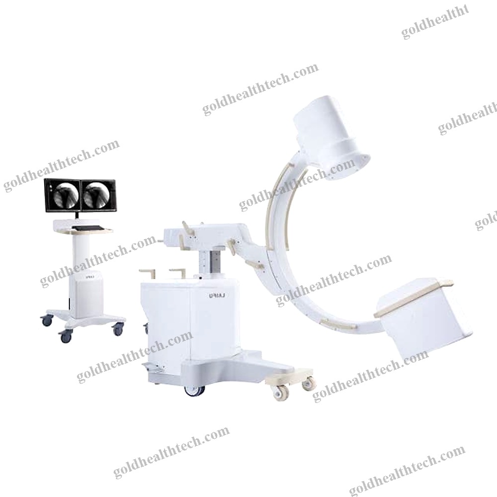 Mobile C-Arm