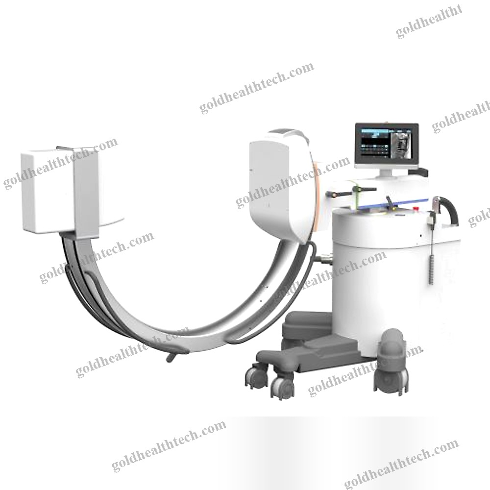 Mobile C-Arm