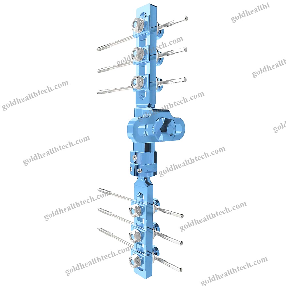 Modular External Fixation System
