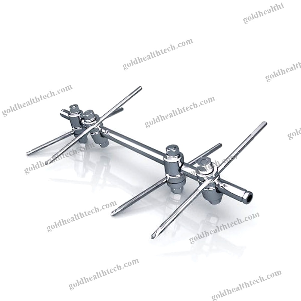 Modular External Fixation System
