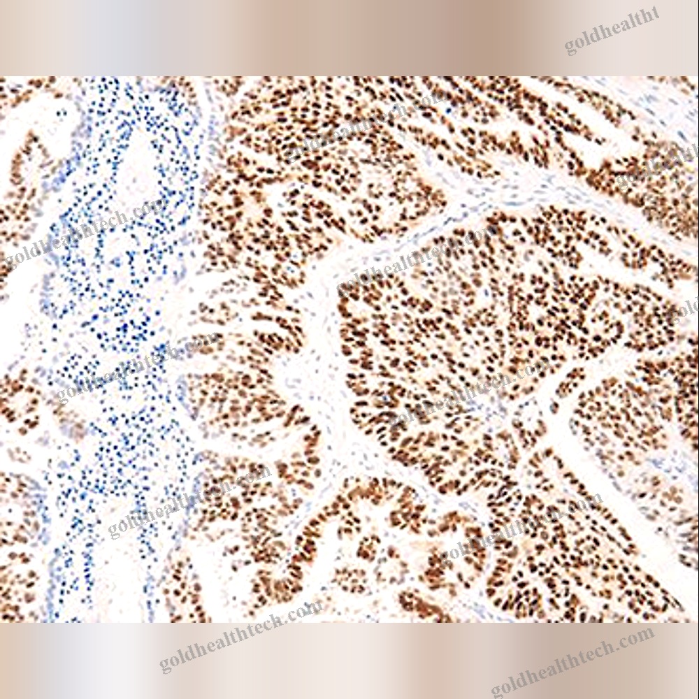 Monoclonal Antibody