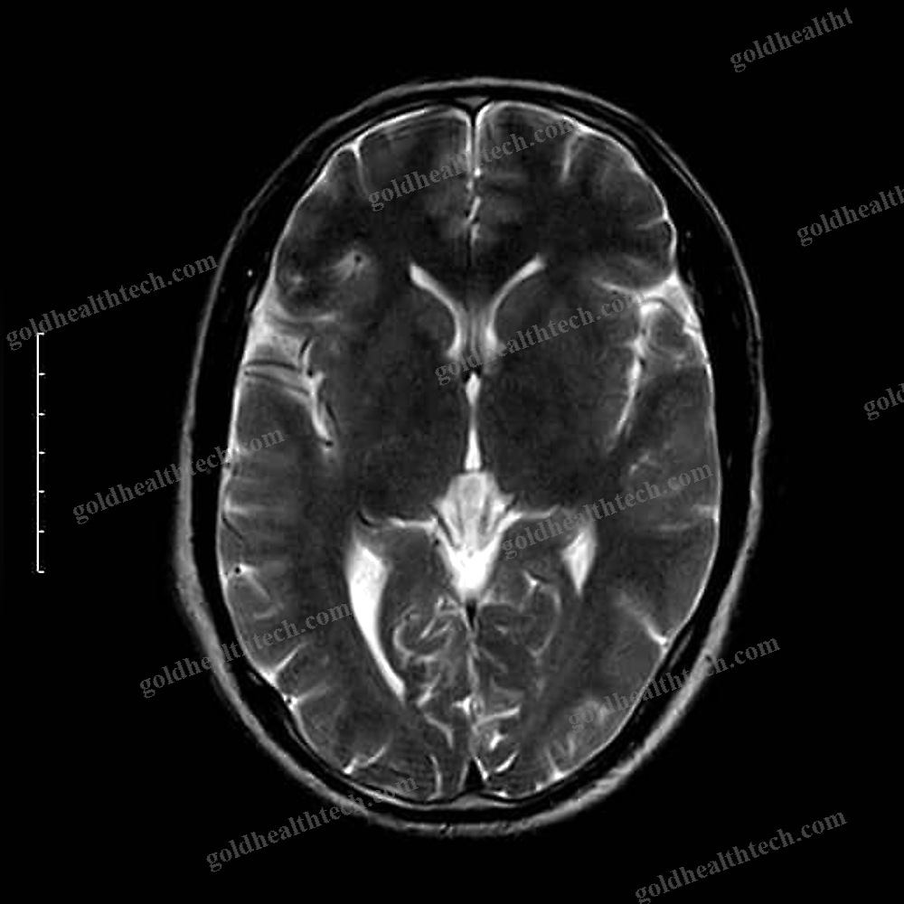 Mri System 1