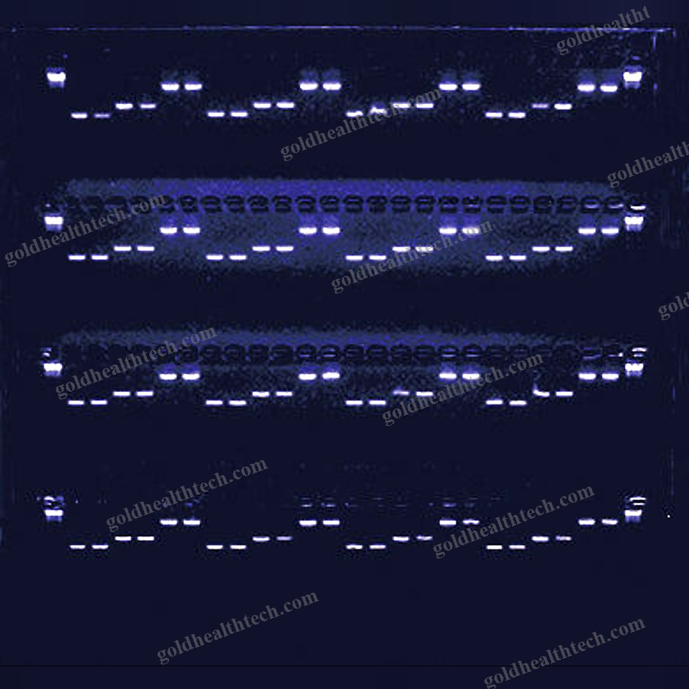 Multifunction Electrophoresis System 1