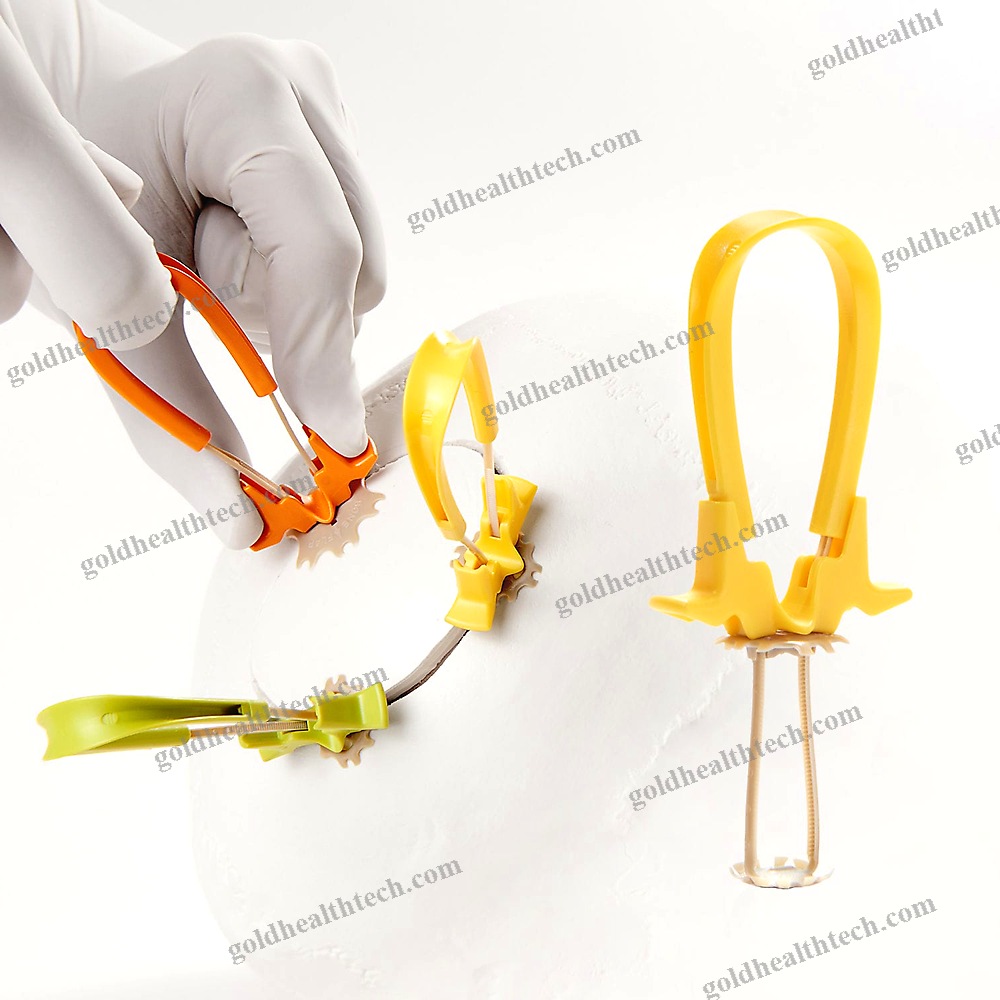 Non-Absorbable Cranial Fixation System