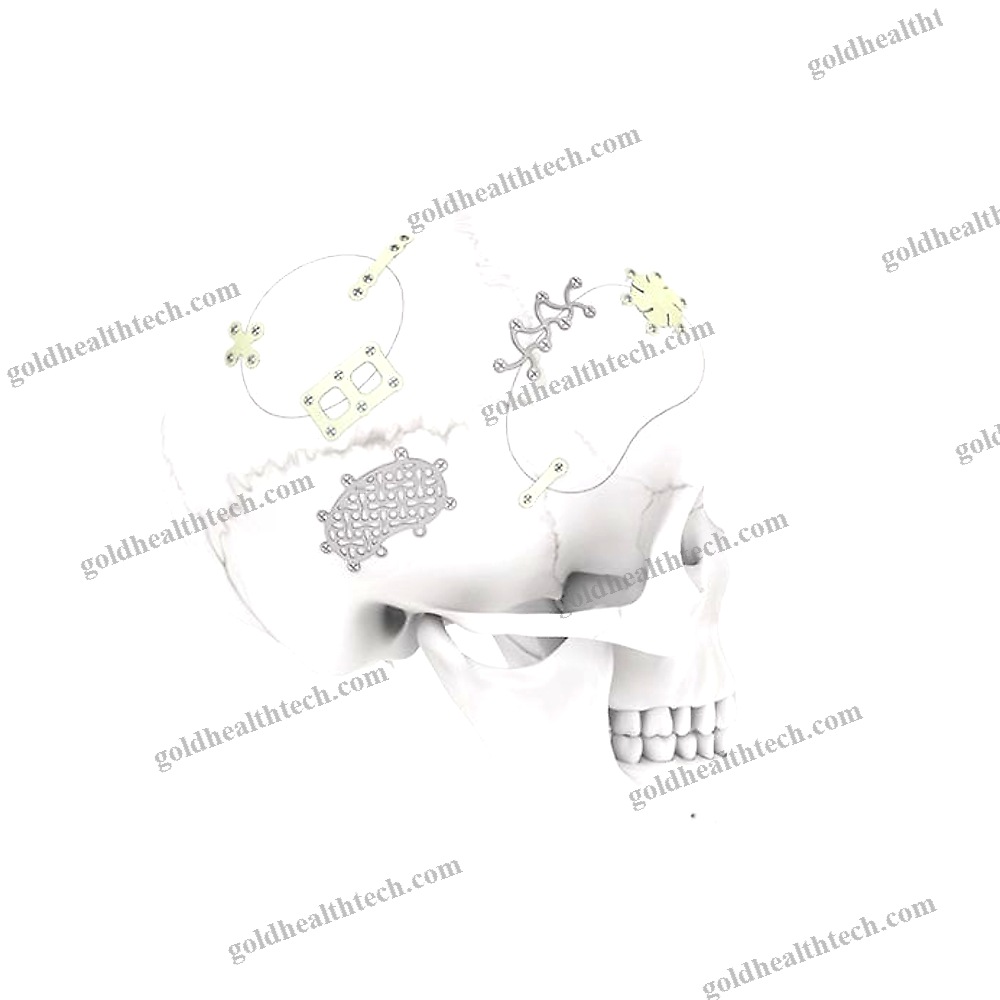 Non-Absorbable Cranial Fixation System