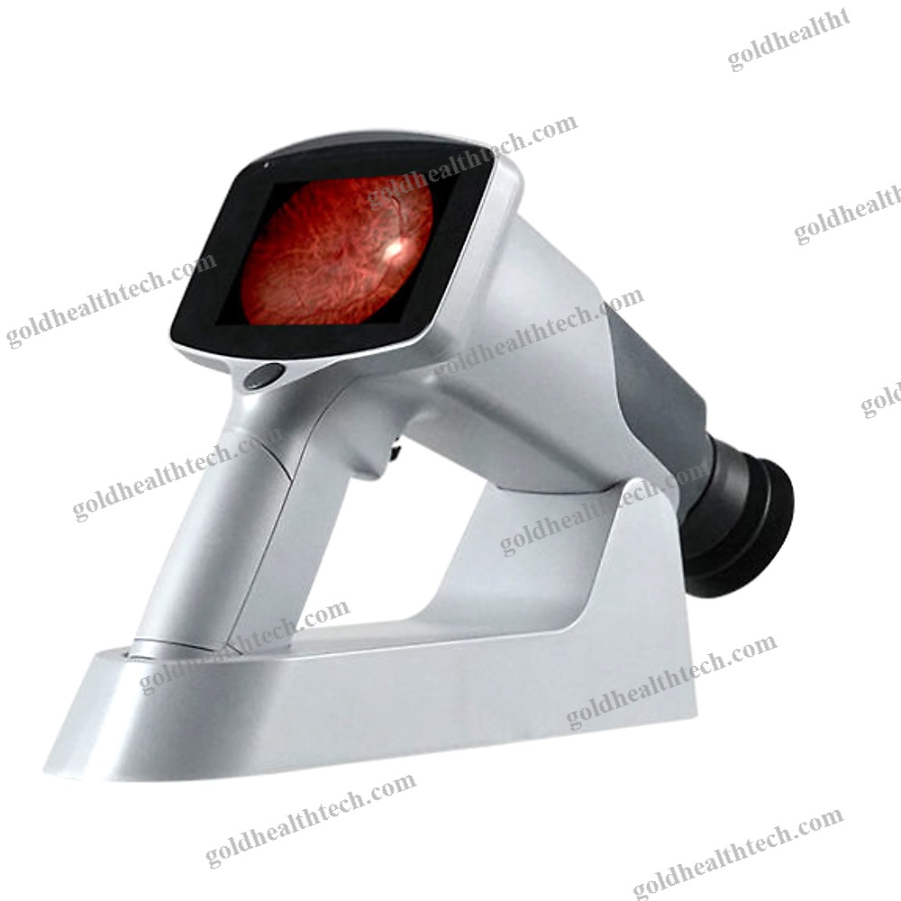 Non-Mydriatic Retinal Camera