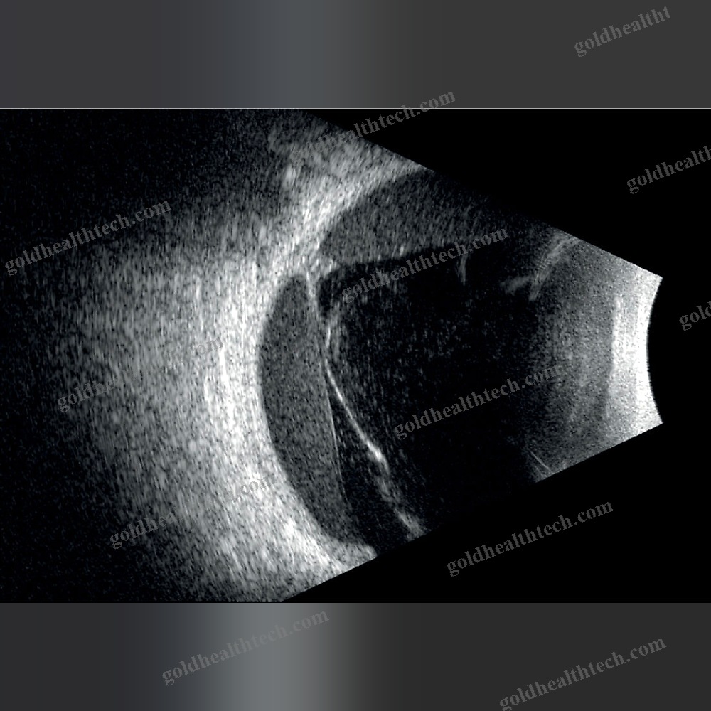 Tabletop Ultrasound System