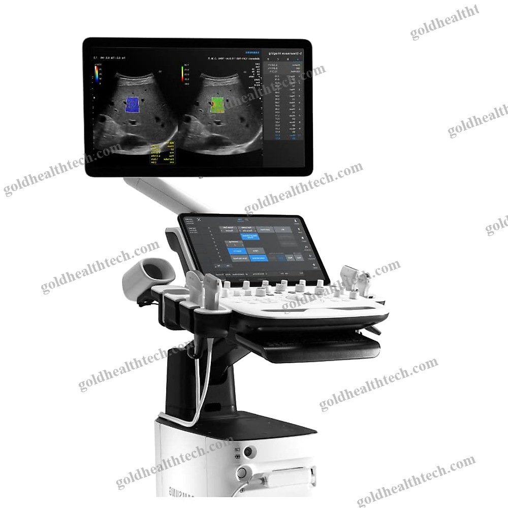 On-Platform Ultrasound System
