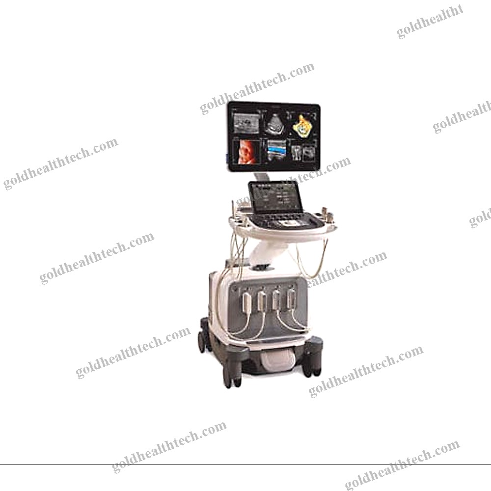 On-Platform Ultrasound System