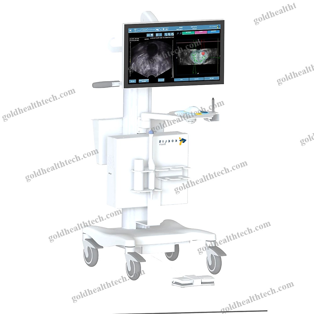 On-Platform Ultrasound System