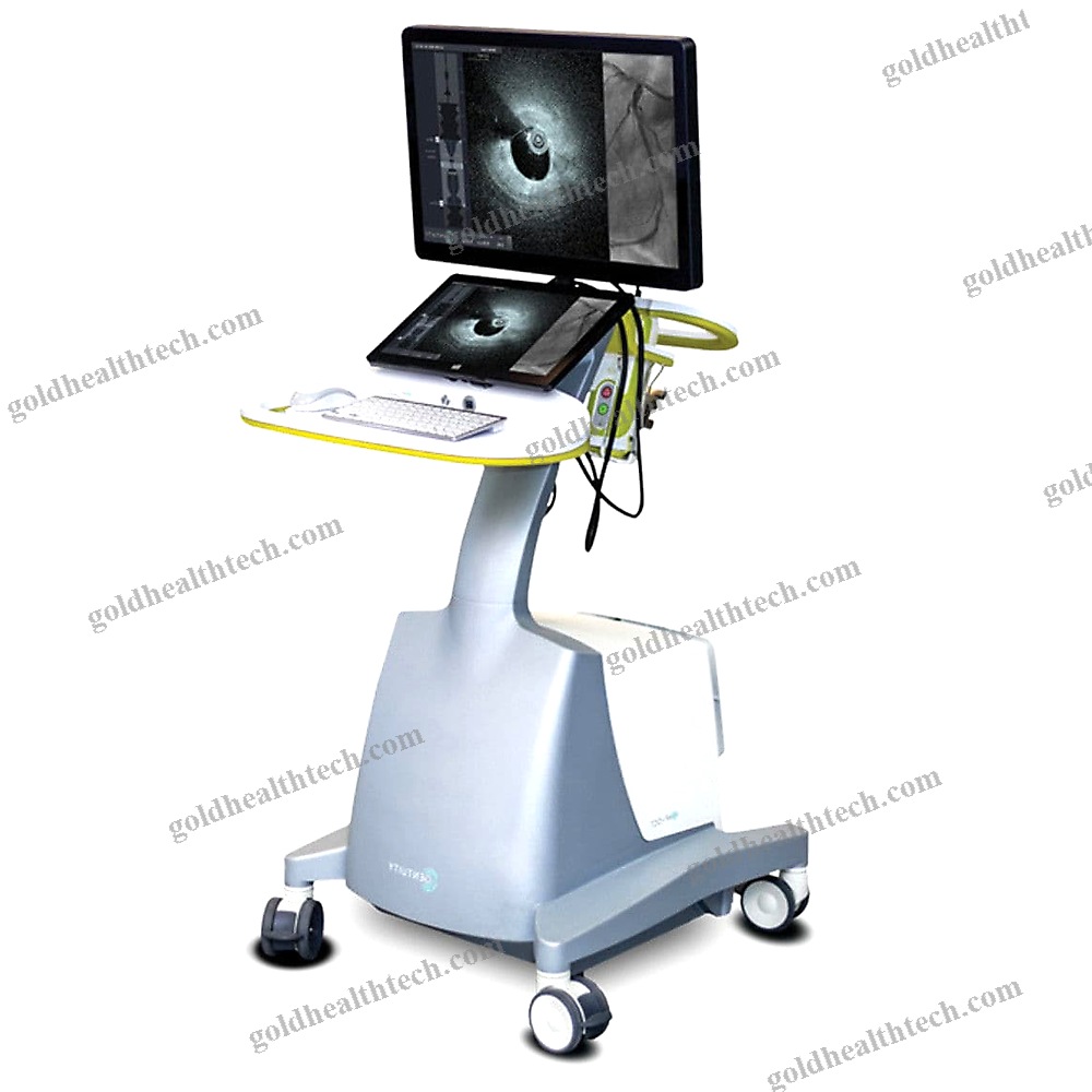 On-Platform Ultrasound System