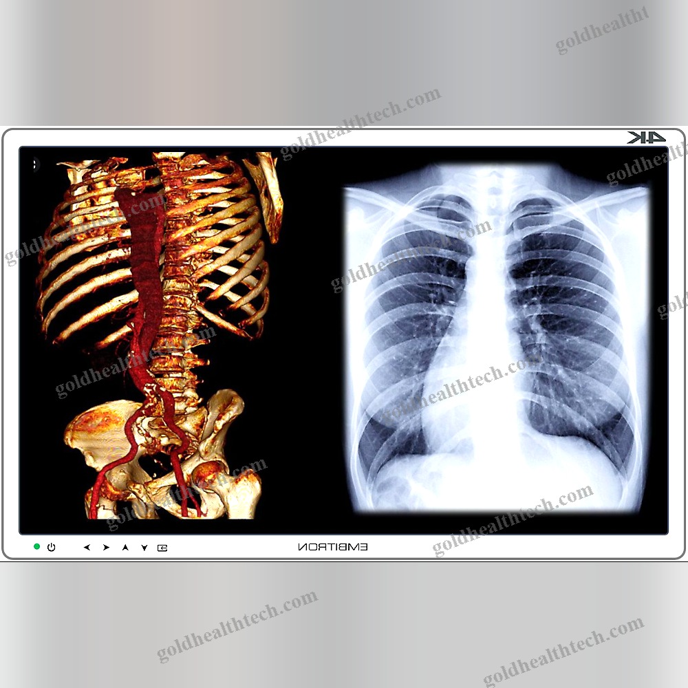 Operating Room Display 1