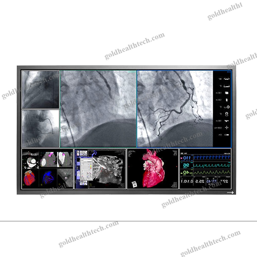 Operating Room Monitor 1