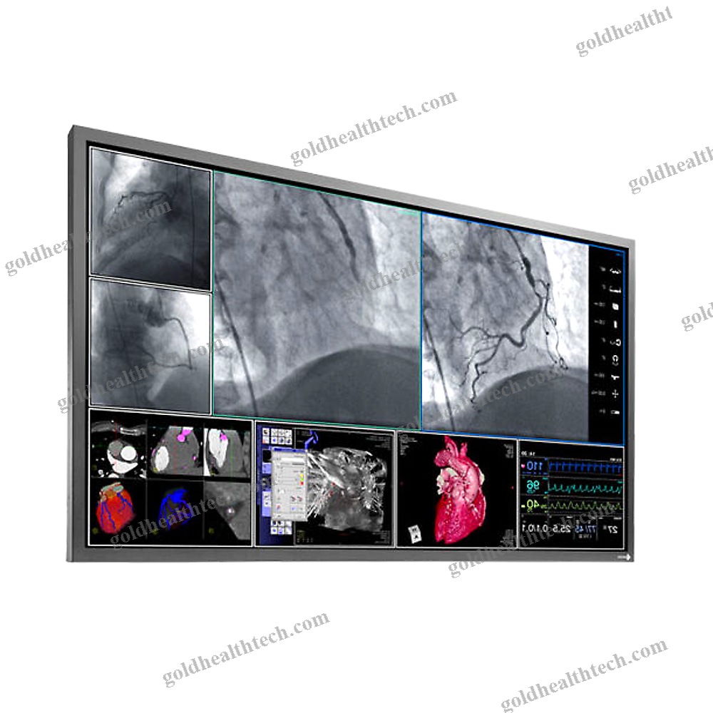 Operating Room Monitor