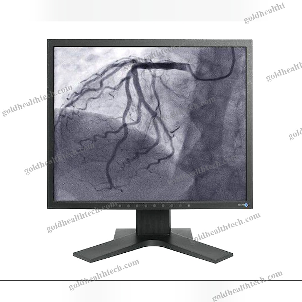 Or Display