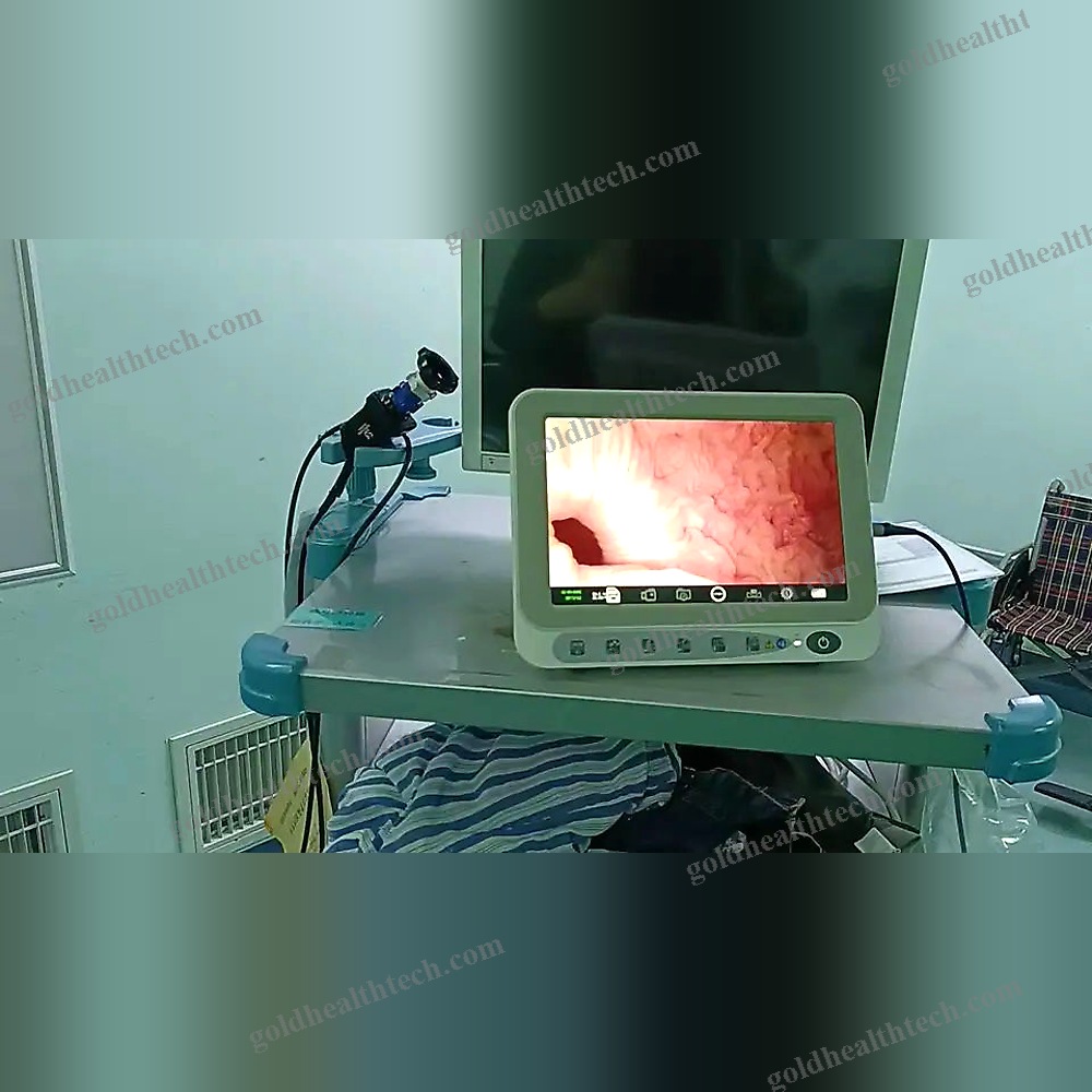 Pediatric Video Cystoscope 1