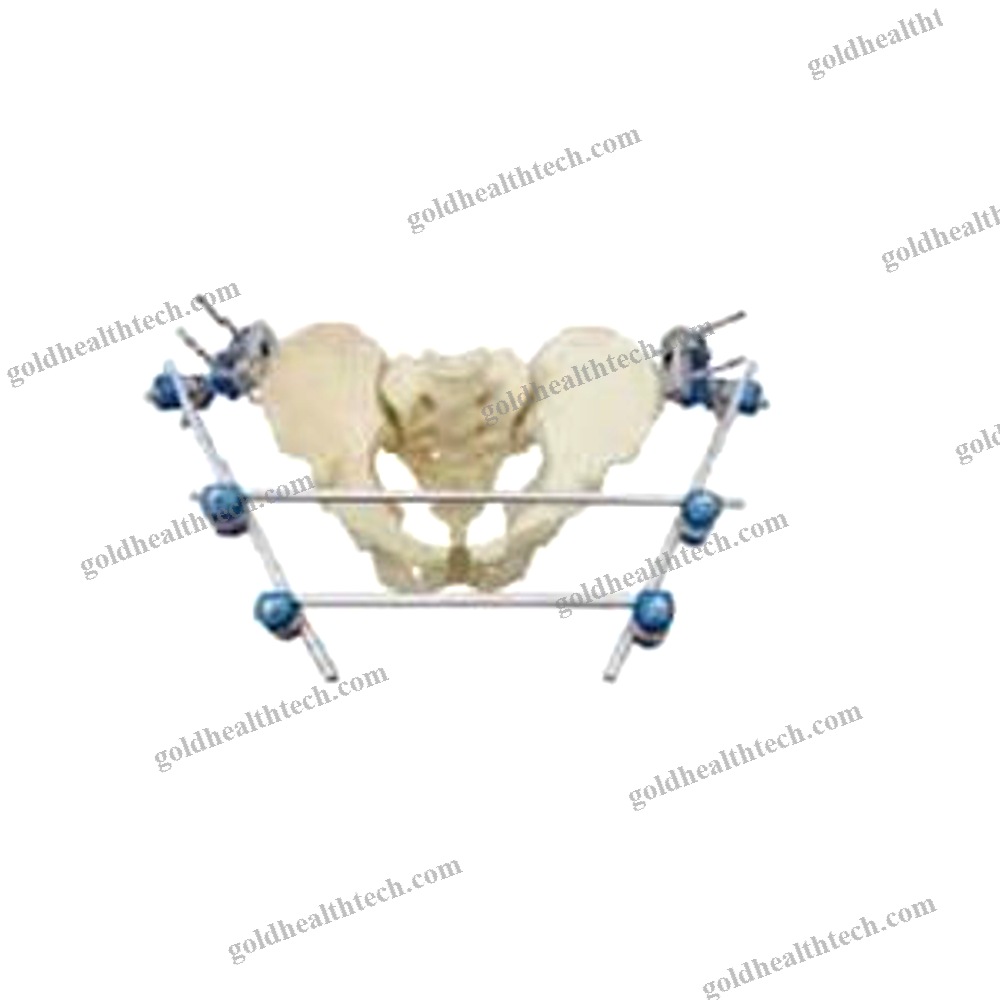 Pelvis External Fixation System