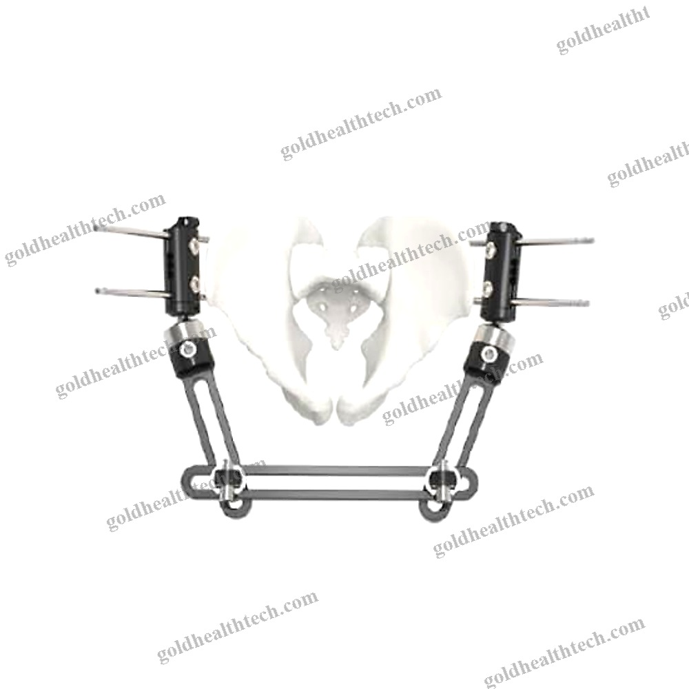 Pelvis External Fixation System 1