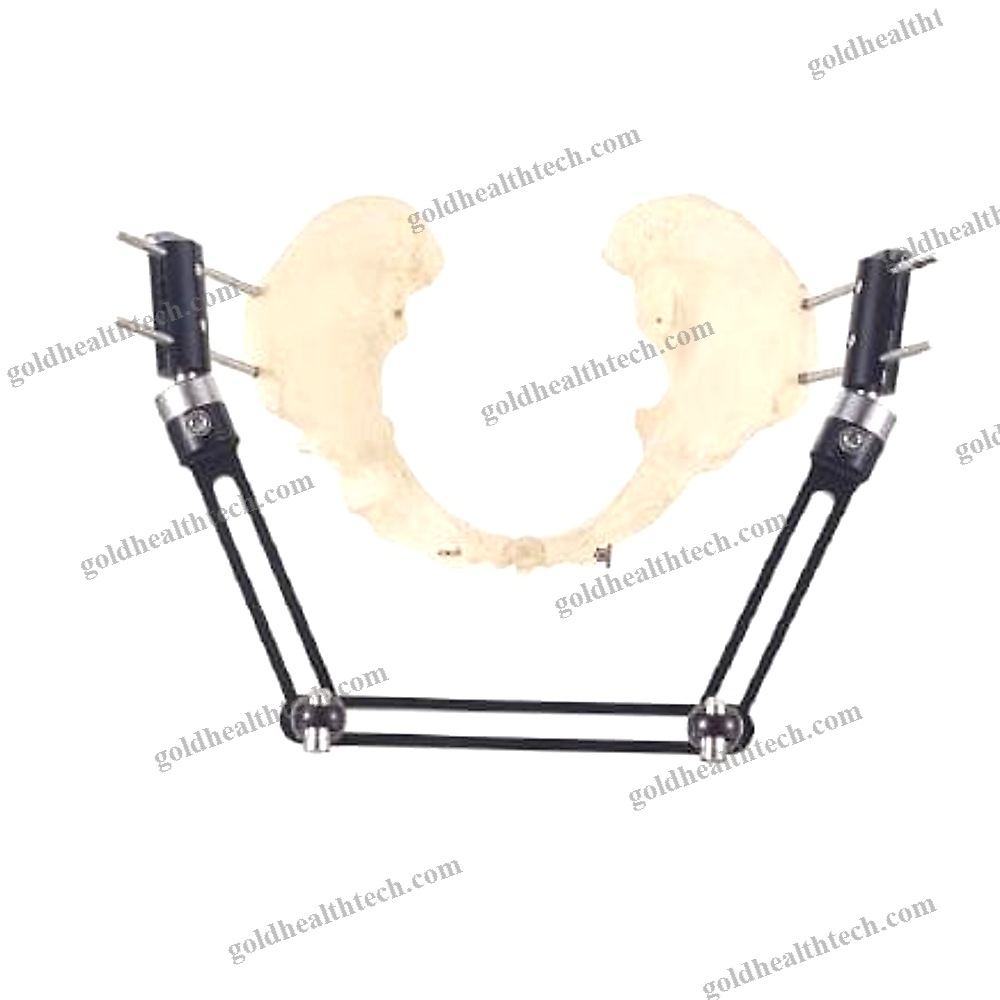 Pelvis External Fixation System