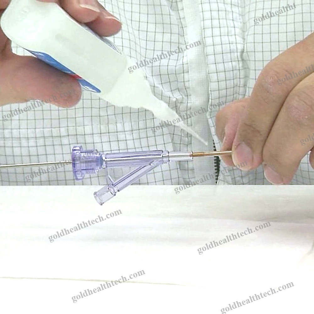 Peripheral Stent
