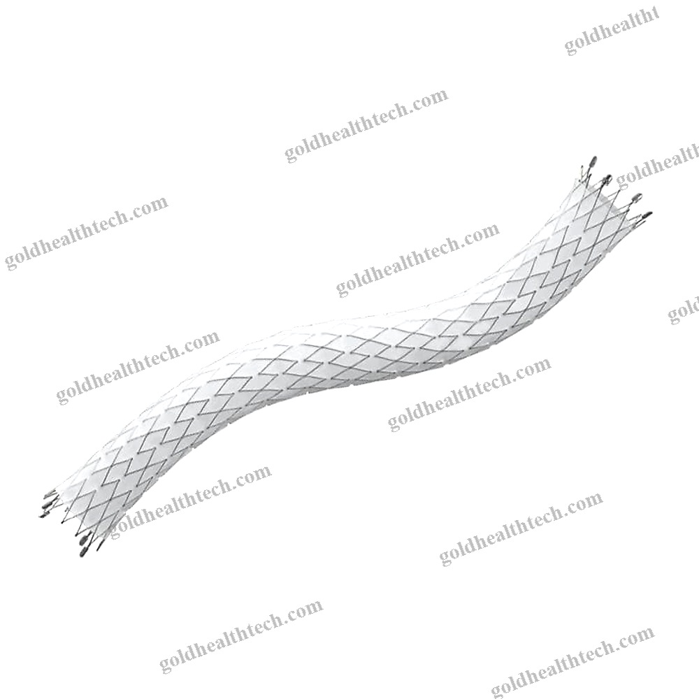 Peripheral Stent Graft