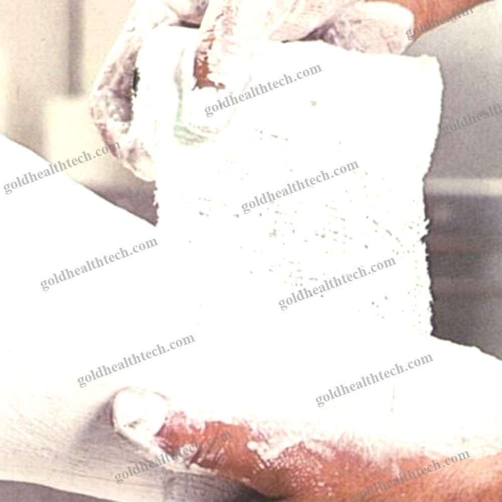 Plaster Of Paris Tape