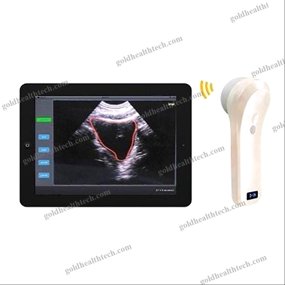 Portable Bladder Scanner