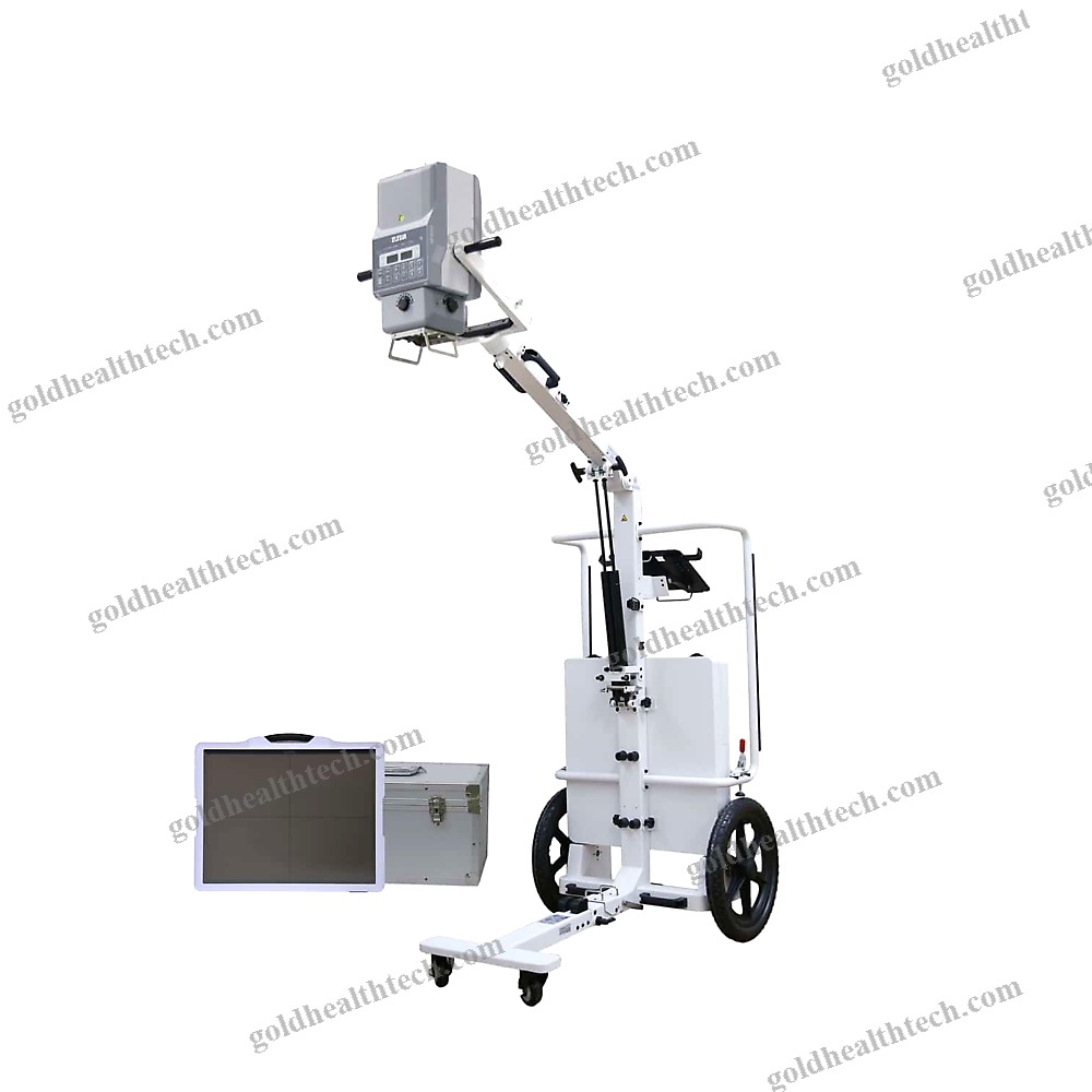 Portable Radiography System
