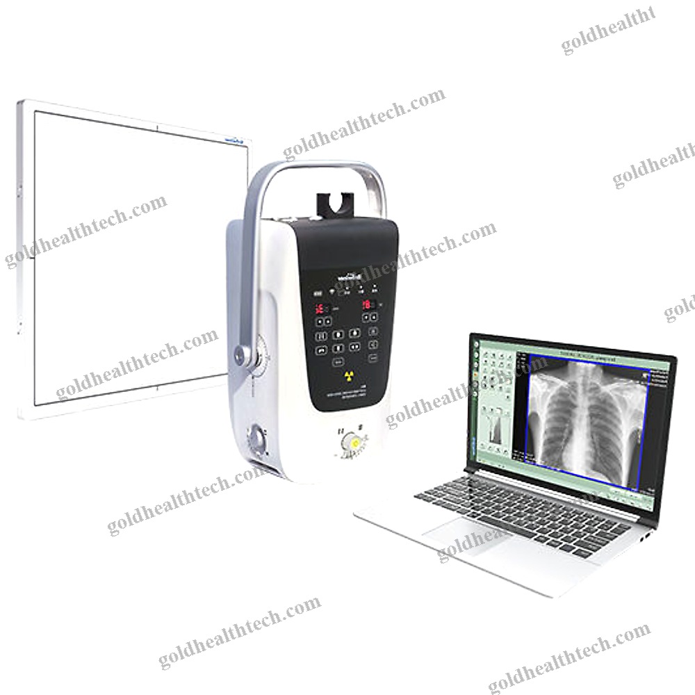 Portable Radiography System