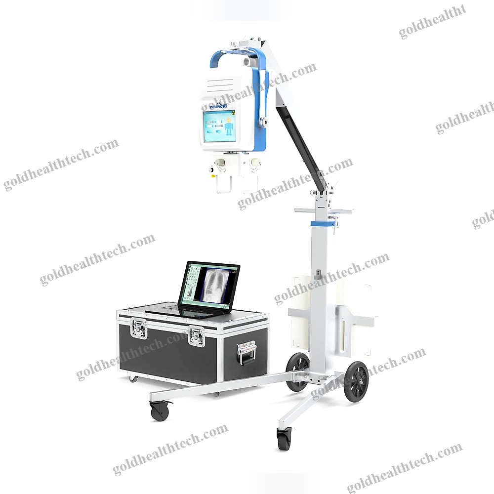 Portable Radiography System 1