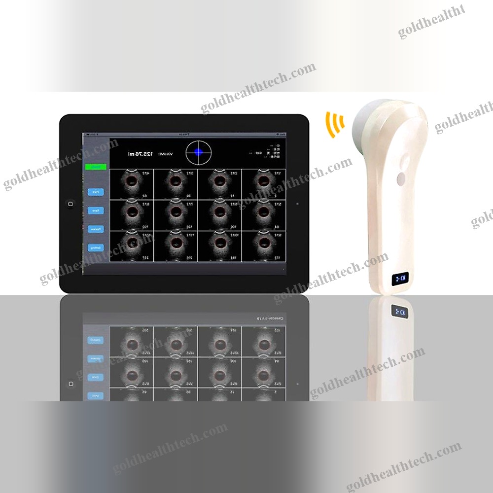 Portable Ultrasound Bladder Scanner 1