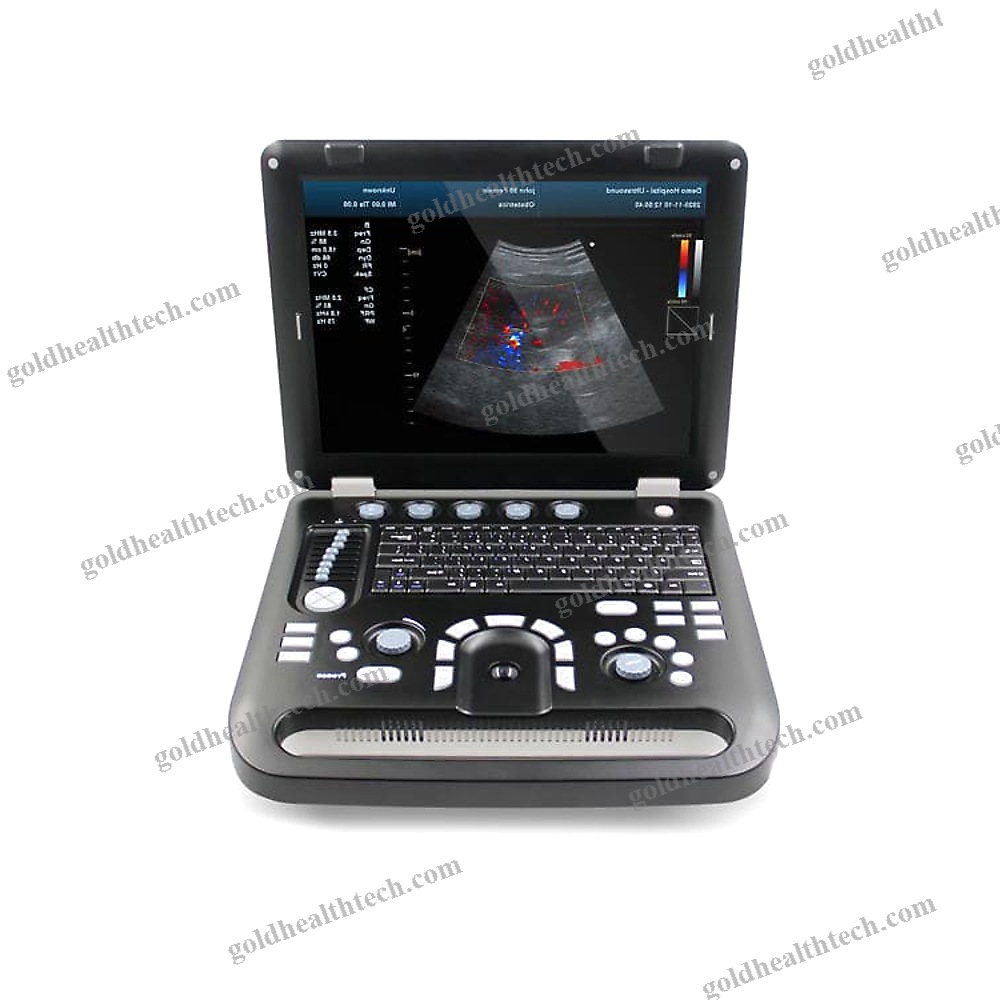 Portable Ultrasound System