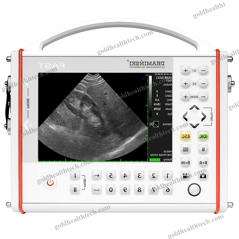 Portable Ultrasound System