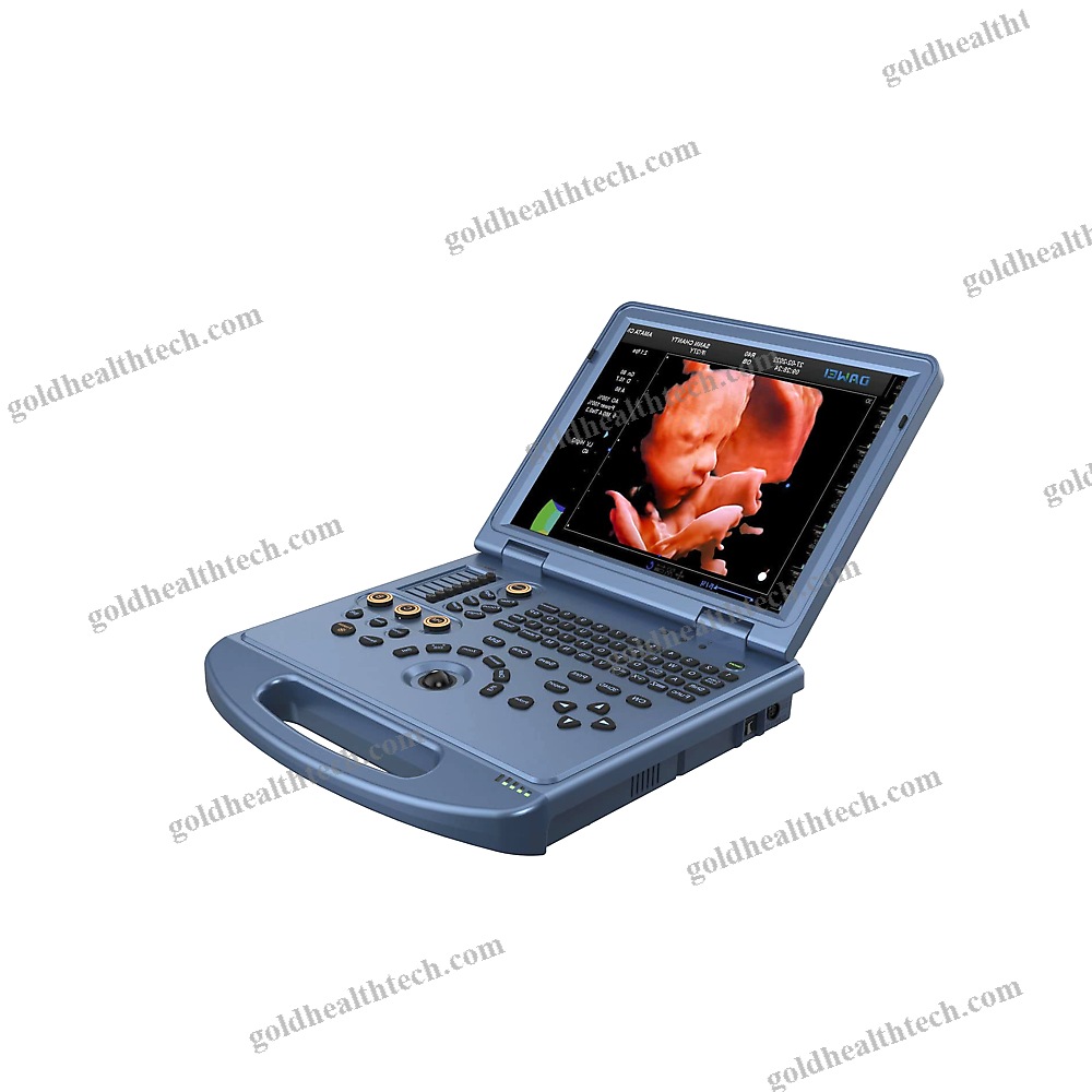 Portable Ultrasound System 1