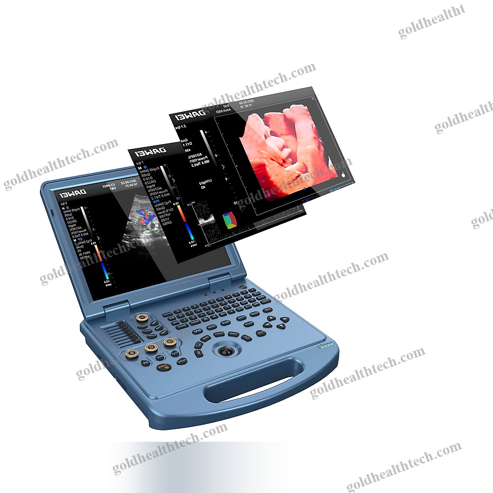 Portable Ultrasound System