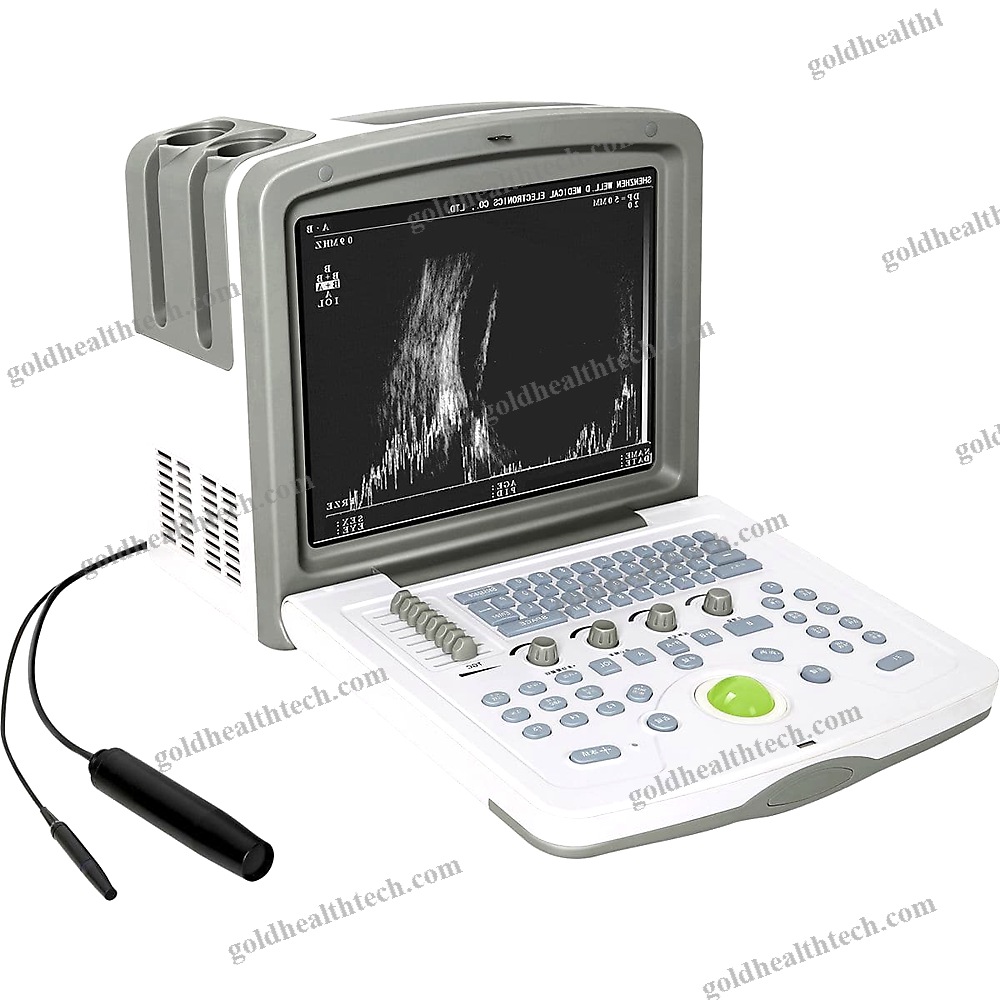 Portable Ultrasound System