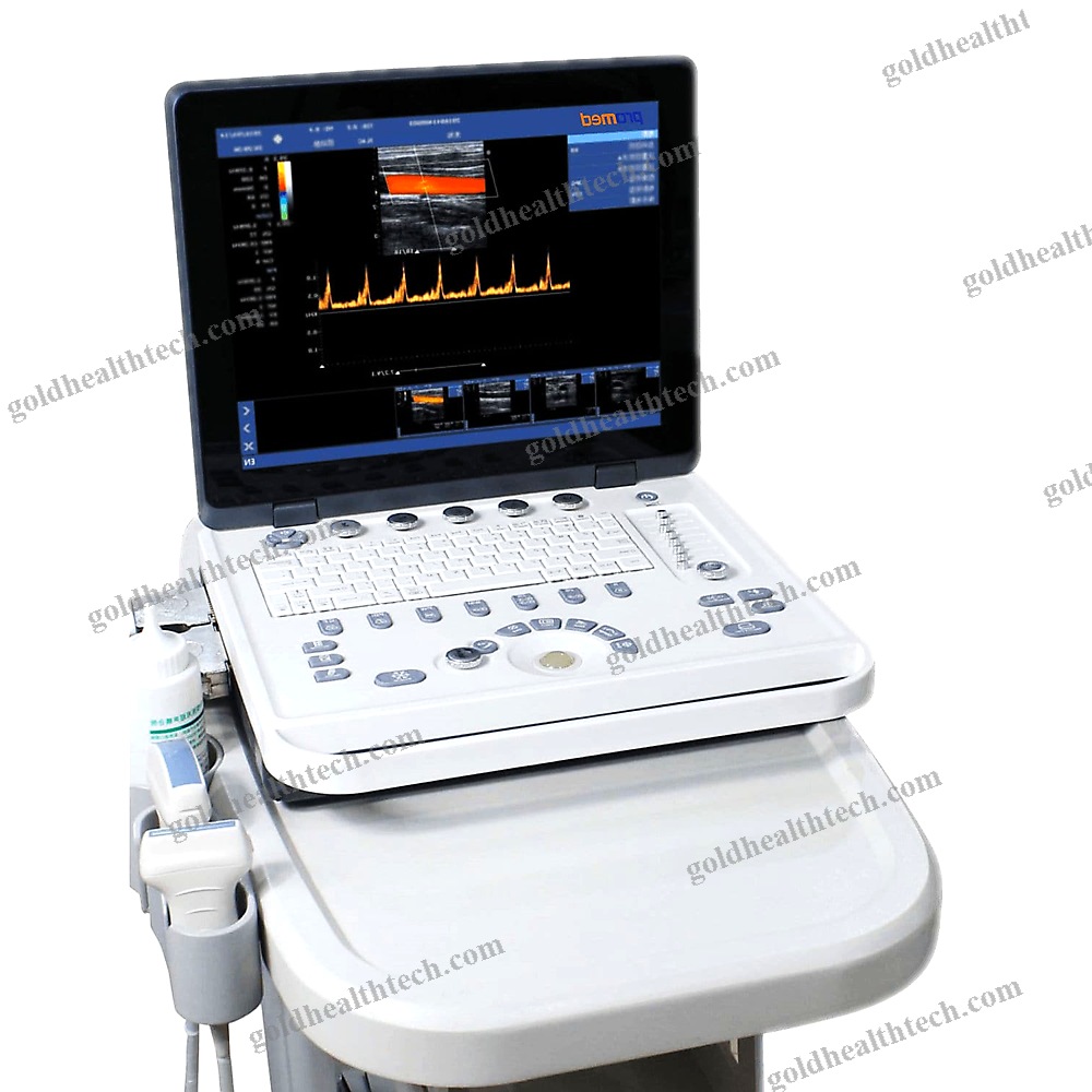 Portable Ultrasound System