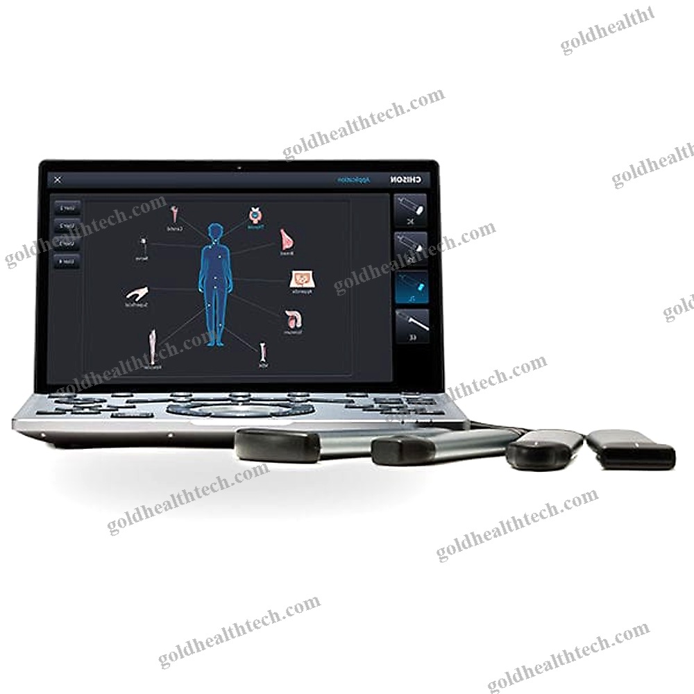 Portable Ultrasound System
