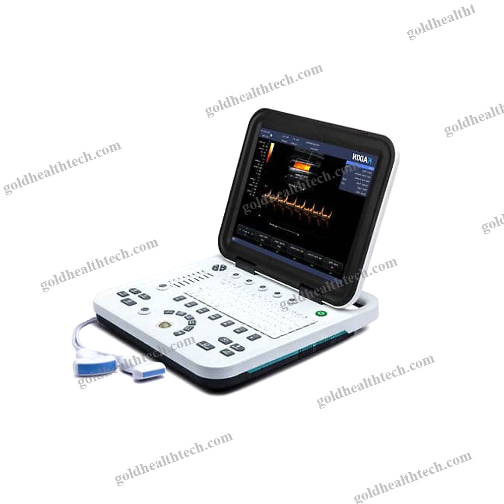 Portable Ultrasound System