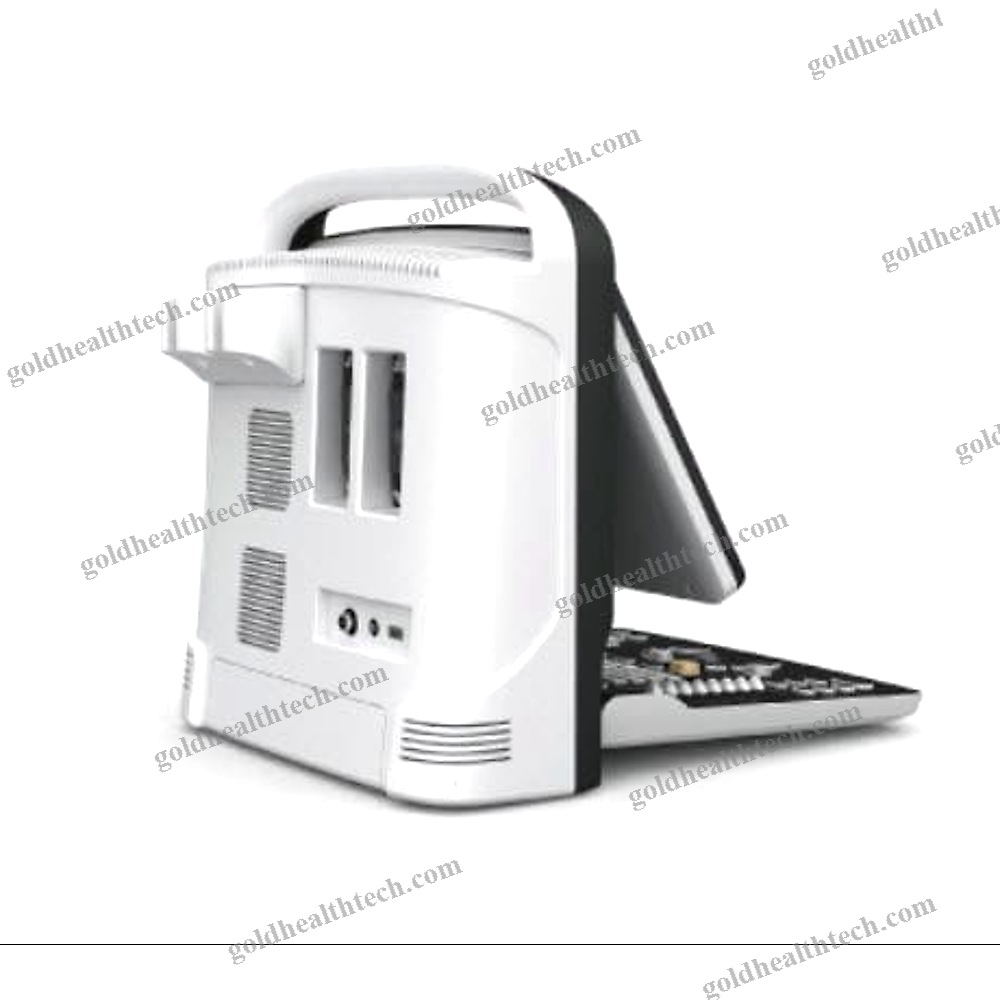 Portable Ultrasound System 1