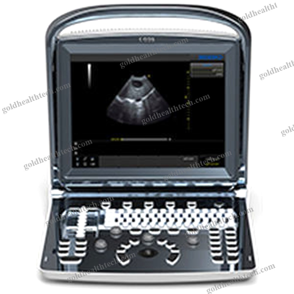Portable Ultrasound System