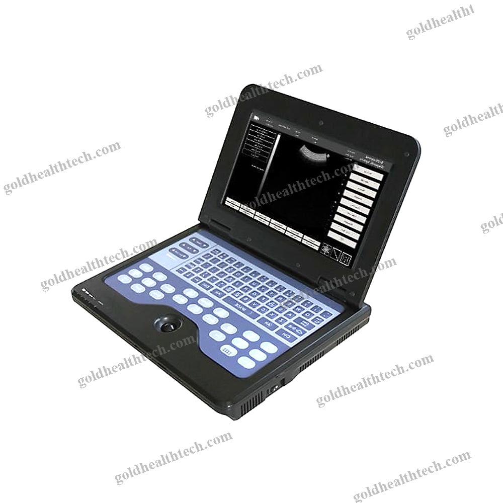 Portable Ultrasound System