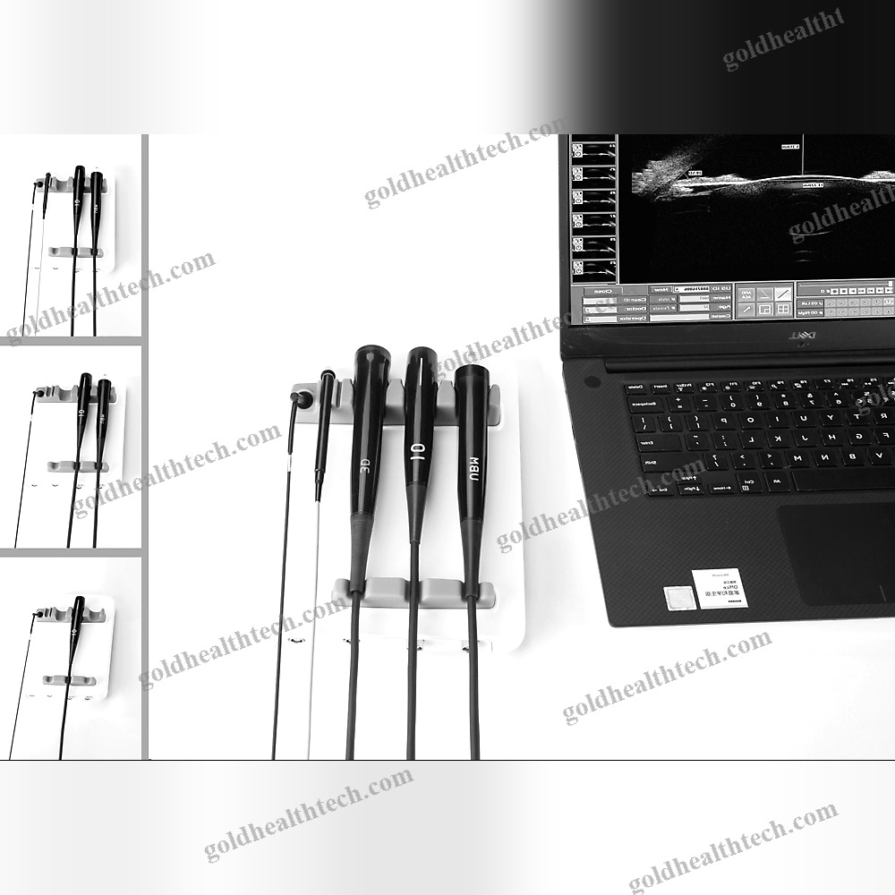 Portable Ultrasound System 1