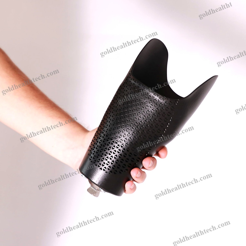 Prosthetic Leg Socket