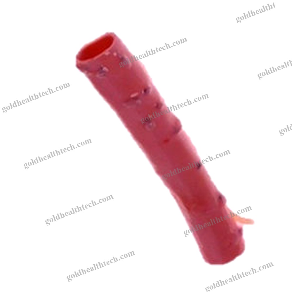 Pulmonary Artery Vascular Bioprosthesis