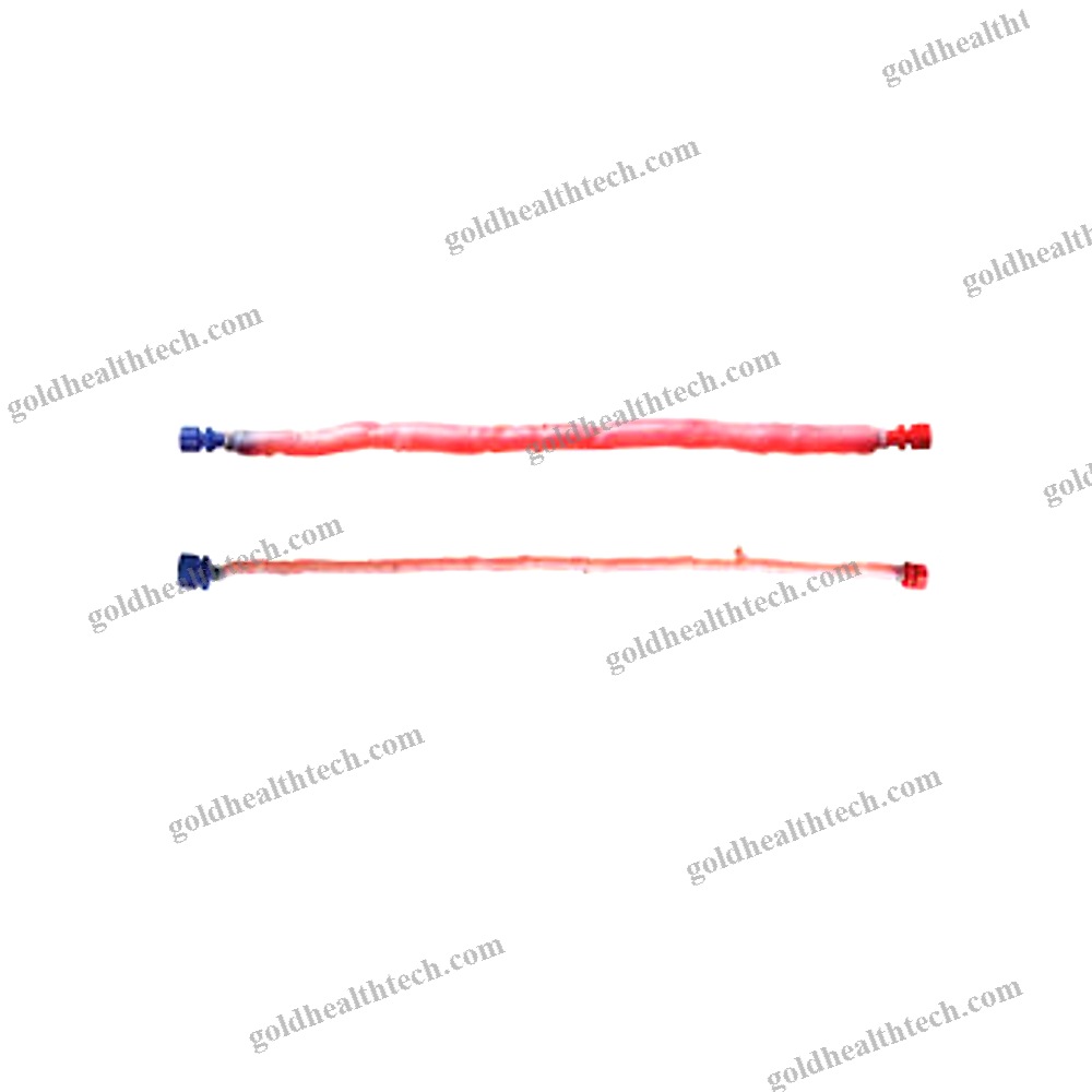 Pulmonary Artery Vascular Bioprosthesis